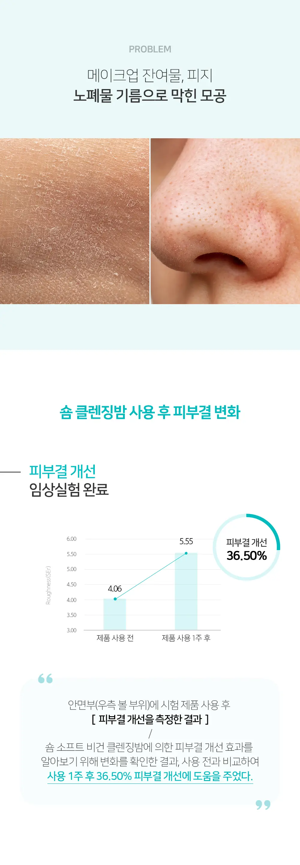 [숌.민감피부] 수분충전 소프트 클렌징밤 1+1기획 상세페이지 10